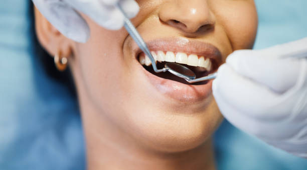 Best Pediatric Emergency Dentist in Ramona, CA